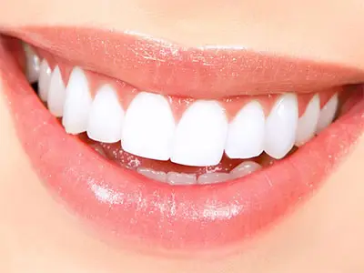 Beautiful veneers in the time you take a vacation!